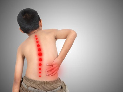 Anak Bawa Ransel Berat Bisa Sebabkan Skoliosis? Begini Penjelasan Dokter