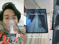 Fakta-fakta Efusi Pleura, Dialami Pria di DKI Usai Merokok dan Rutin Nge-vape