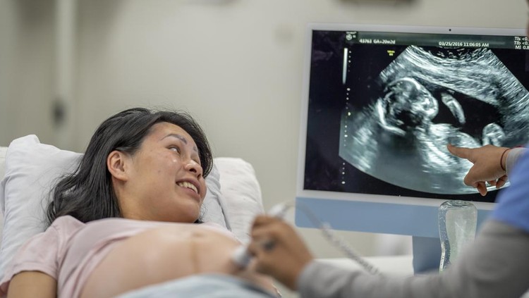 USG hamil A pregnant female of Asian decent, lays out on an exam table as a technician conducts her ultrasound. She is dressed casually and has her belly exposed as she looks to the screen to see her baby.