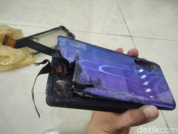 Ponsel Terbakar di Saku, Paha-Jari Tangan Ketua Karang Taruna Asahan Luka