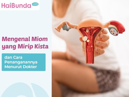 Mengenal Miom yang Mirip Kista dan Cara Penanganannya Menurut Dokter