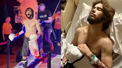 Bahaya Efek Buruk Vape, Atlet MMA Ini Kolaps hingga Paru-parunya Dipotong