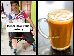 Minum 3 Gelas Teh Tarik Tiap Hari Selama 30 Tahun, Kaki Pria Ini Diamputasi!