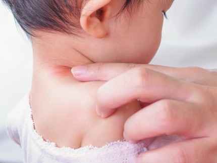 Benjolan di Leher Bayi: Kenali Penyebab dan Cara Mengatasinya
