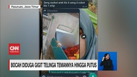 VIDEO: Bocah Diduga Gigit Telinga Temannya Hingga Putus