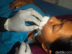 Satu Keluarga di Bali Digigit Anjing Rabies, Begini Kondisi Para Korban