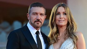 Nicole Kimpel, Model Sekaligus Pacar Antonio Banderas