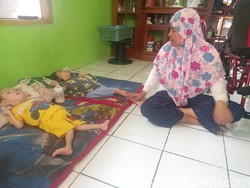 Tolong! Kakak-Adik Subang Pengidap Lumpuh Otak Butuh Bantuan