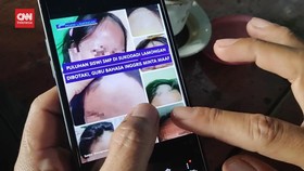 VIDEO: Gara-Gara Tak Pakai Ciput, 19 Siswi SMP Dibotaki Oknum Guru