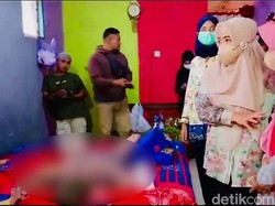 Derita Gadis Belia di Tegal Idap Penyakit SSSS, Sekujur Tubuh Melepuh
