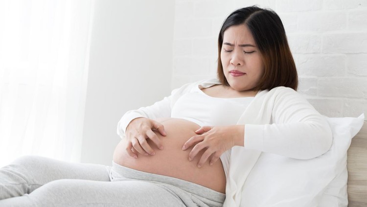 Ilustrasi hamil gatal Southeast asian pregnant women itching of the skin belly which causes striped. Problems of pregnancy women and Stretch marks or striae concept