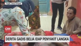 VIDEO: Derita Gadis Belia Idap Penyakit Langka