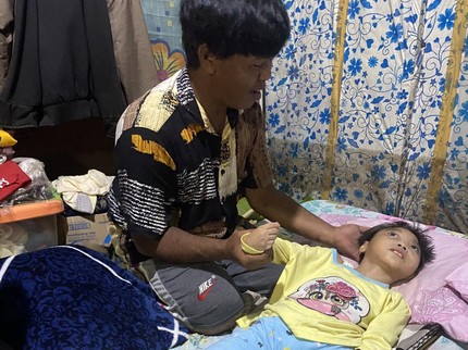 Lemah Tak Berdaya Hidup Anak Tukang Becak Alami Mikrosefalus