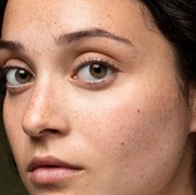 7 Kesalahan Perawatan Wajah Ini Bikin Munculnya Flek Hitam di Usia Muda, Kamu Suka Lakukan?