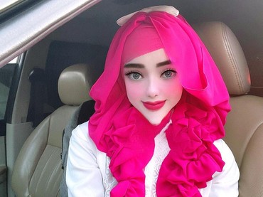 img-title Demi Dagu Lancip, PNS Viral Yuni Jasmine Oplas Capai Miliaran?