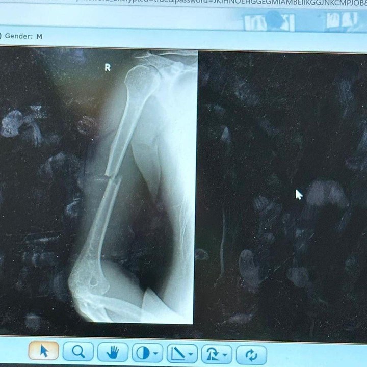 <p>Sebelumnya diketahui, Irwansyah baru saja mengalami musibah saat berkuda. Kejadian tersebut pun membuat pria 38 tahun itu mengalami patah tulang dan harus dirawat di rumah sakit selama beberapa hari. (Foto: Instagram@irwansyah_15)</p>