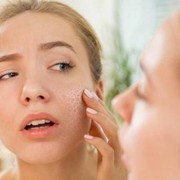 5 Kesalahan Perawatan Wajah yang Bisa Bikin Kulit Iritasi, Kalau Mau Cantik Glowing Coba Hindari Ya!