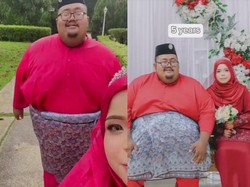 Awal Mula Viral Perjuangan Istri Dampingi Suami yang Obesitas, Bobotnya 300 Kg
