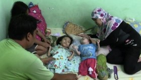 Donasi untuk Alkha dan Akhtar, Anak Buruh Penderita Cerebral Palsy
