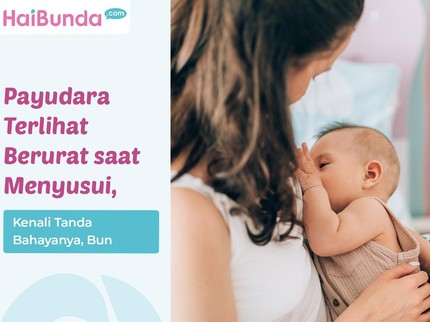 Payudara Terlihat Berurat saat Menyusui, Kenali Tanda Bahayanya, Bun