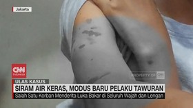 VIDEO: Ulas Kasus : Siram Air Keras, Modus Baru Pelaku Tawuran
