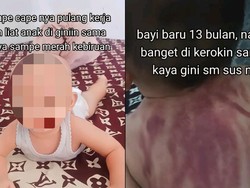 Viral Ibu Curhat Anaknya Dikerok oleh Pengasuh sampai Punggung Merah-Kebiruan