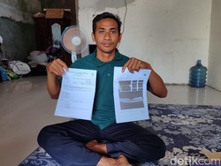 Mata Siswi SD Dicolok Tusuk Bakso, Ayah Sebut Sekolah PHP soal CCTV