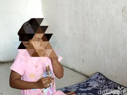Janji Dispendik Gresik Tak Akan Tutupi Kasus Siswi Buta Dicolok Tusuk Bakso