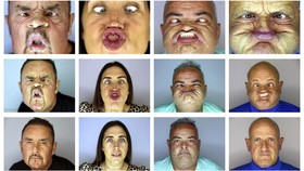 FOTO: Ekspresi Kocak Para Peserta World Gurning Championships