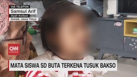VIDEO: Mata Siswa SD Buta Terkena Tusuk Bakso