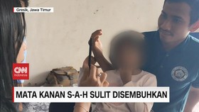 VIDEO: Mata Kanan S-A-H Sulit Disembuhkan