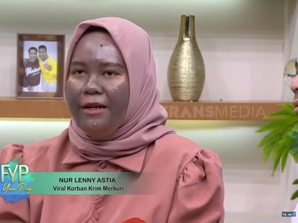 Kabar Terbaru Lenny, Perempuan yang Wajahnya Gosong karena Merkuri dari Skincare Abal-abal