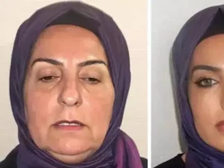 Viral Foto Before After Wanita 68 Tahun Oplas, Bikin Kaget Dikira Beda Orang