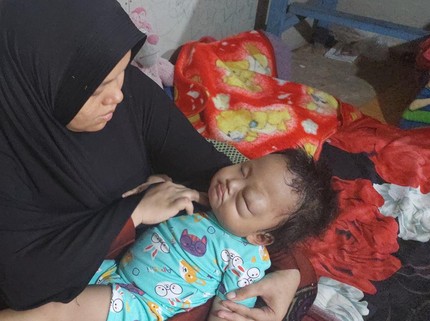 Derita dan Tangis Anak Penjual Bihun Gulung Pengidap Tumor Mata