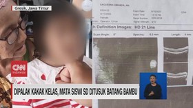VIDEO: Dipalak Kakak Kelas, Mata Siswi SD Ditusuk Batang Bambu