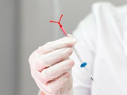Membedah Keuntungan dan Kerugian Gunakan KB IUD