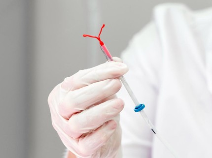 Ketahui Prosedur Pemasangan KB IUD pada Perempuan