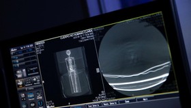 NASA Sindir Habis Klaim 'Alien' Meksiko