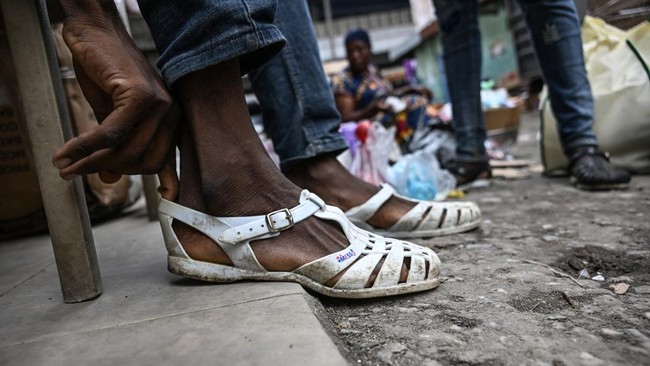 FOTO: 'Leke', Sandal Jellyfish yang Jadi Identitas Pantai Gading