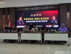 Penjelasan Dokter soal Hasil MRI Mata Siswi SD di Gresik