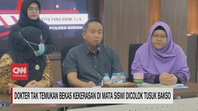 VIDEO: Keanehan Hasil Pemeriksaan MRI Siswi Mata Dicolok Tusuk Bakso