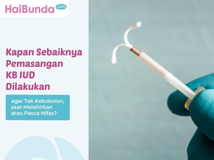 Kapan Sebaiknya Pemasangan KB IUD Dilakukan agar Tak Kebobolan, saat Melahirkan atau Pasca Nifas?