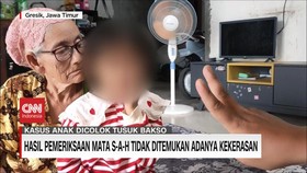 VIDEO: Hasil Pemeriksaan Mata SAH Tidak Ditemukan Adanya Kekerasan