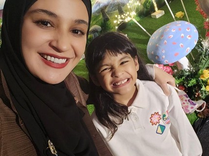 Cerita Hawwa Putri Shireen Sungkar Jatuh saat Main, Kaki Retak & Harus Pasang Gips
