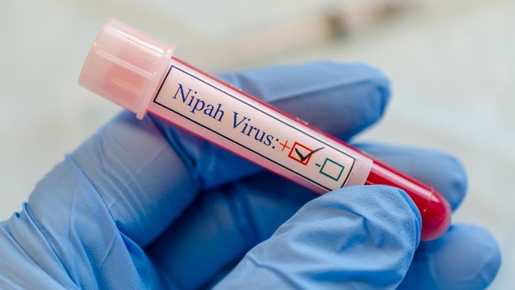 A tube contain fictitious Nipah virus contain blood