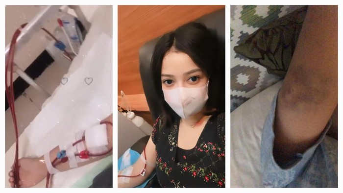 Ngeluh Gejalanya Mirip GERD, Ini Kronologi Perempuan Bandung Kena Gagal Ginjal Stadium Akhir