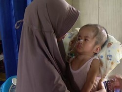 Yuk Bantu Rizky, Anak Tukang Bengkel Berjuang Sembuh dari Hidrosefalus