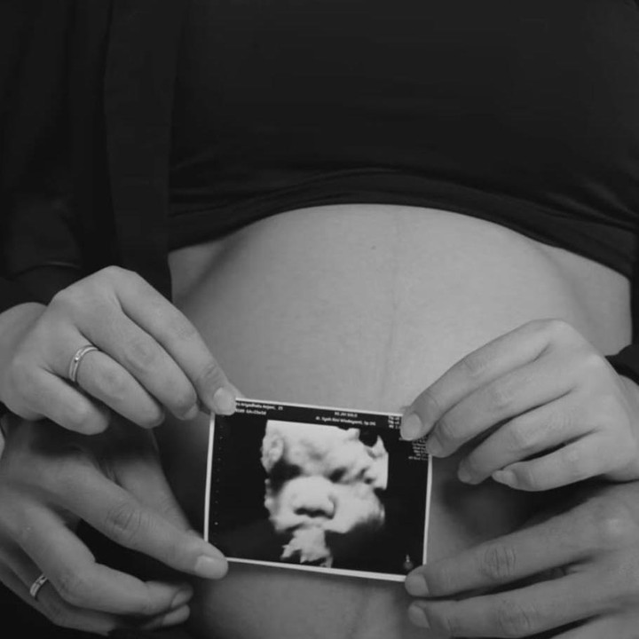 <p>Pada sebuah unggahan, Anya meminta pengikutnya untuk menebak jenis kelamin anak mereka. "ada yang bisa tebak baby nya cewe/ cowo," tulis Anya. Banyak pengikutnya yang ikut menebak dengan berbagai macam jawaban. (Foto: Instagram @anyaanjani)</p>