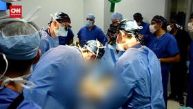 VIDEO: Dokter Di AS Kembali Transplantasi Jantung Babi Ke Manusia