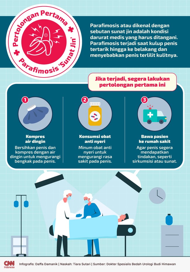 Parafimosis atau dikenal dengan sebutan sunat jin adalah kondisi darurat medis yang harus ditangani. Jika terjadi segera lakukan pertolongan pertama ini.